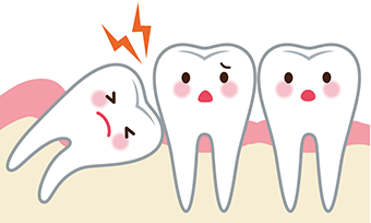 親知らずのトラブル
