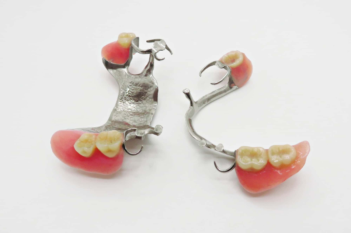 金属床義歯のイメージ