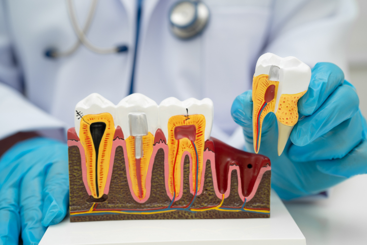 歯と根管の構造について説明する様子