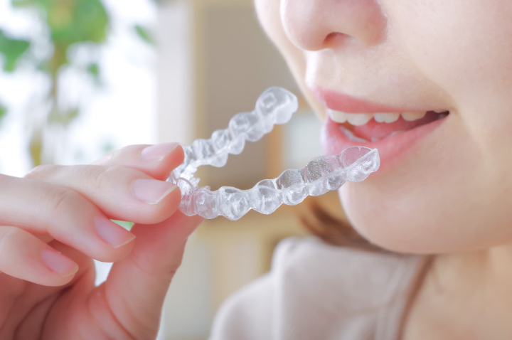 マウスピース矯正とは？特徴・メリット・費用・治療の流れまで徹底解説