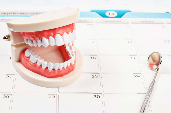 審美歯科の治療期間と通院頻度を示すイメージ