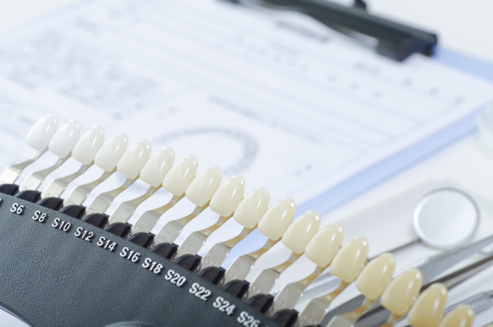 ホワイトニングのカウンセリング