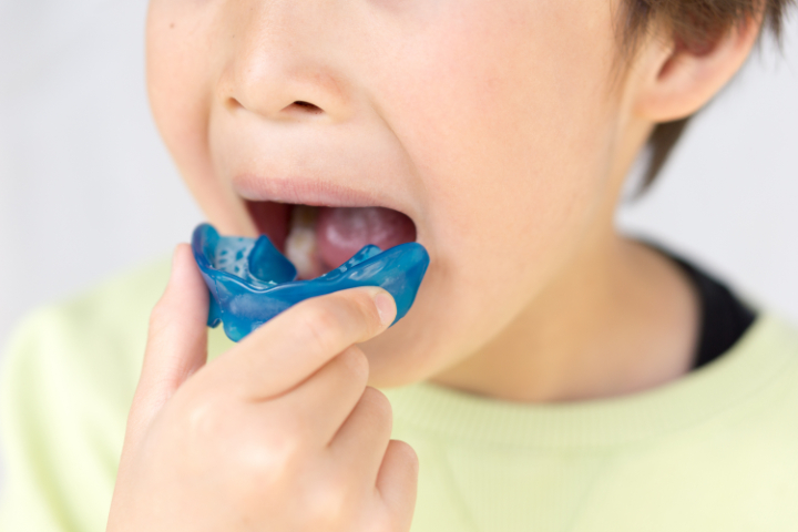 プレオルソのアライナーを装着する子ども