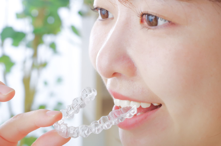 インビザラインのマウスピースを装着しようとしている女性