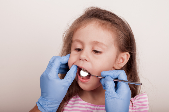 歯肉炎のチェックを受ける女の子