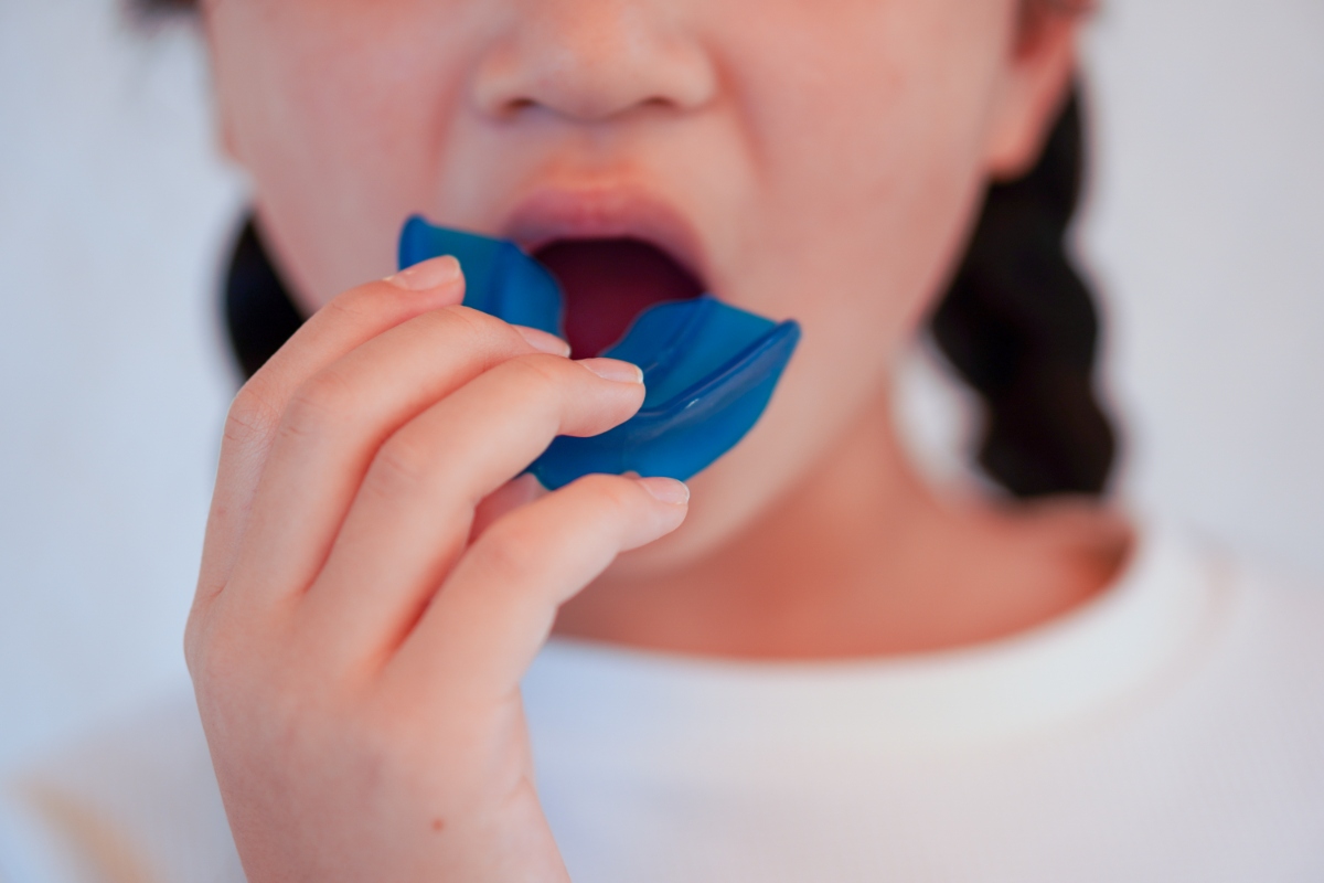 プレオルソ矯正をしている子ども
