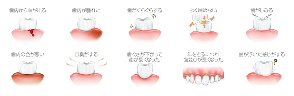 歯周病の症例